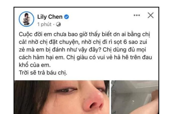 Lily Chen bi hanh hung